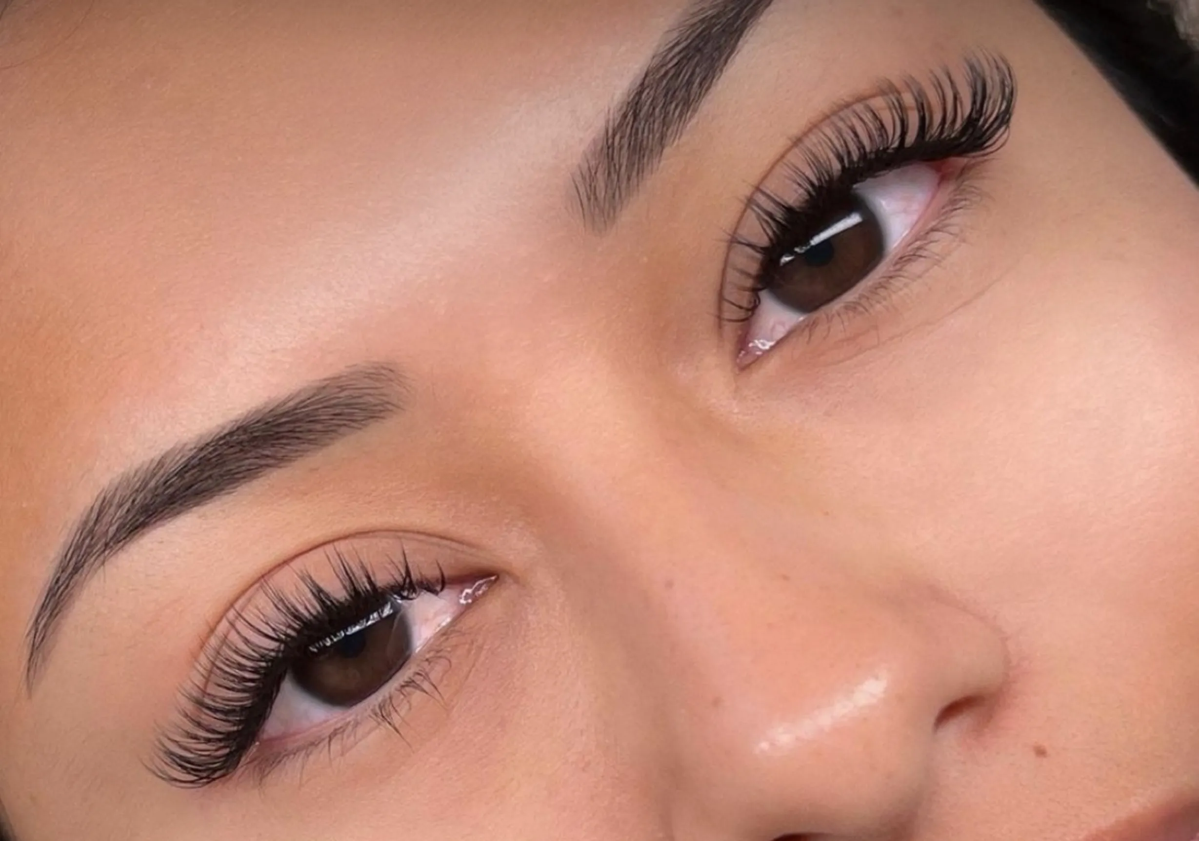 eyelash glue allergy treatment