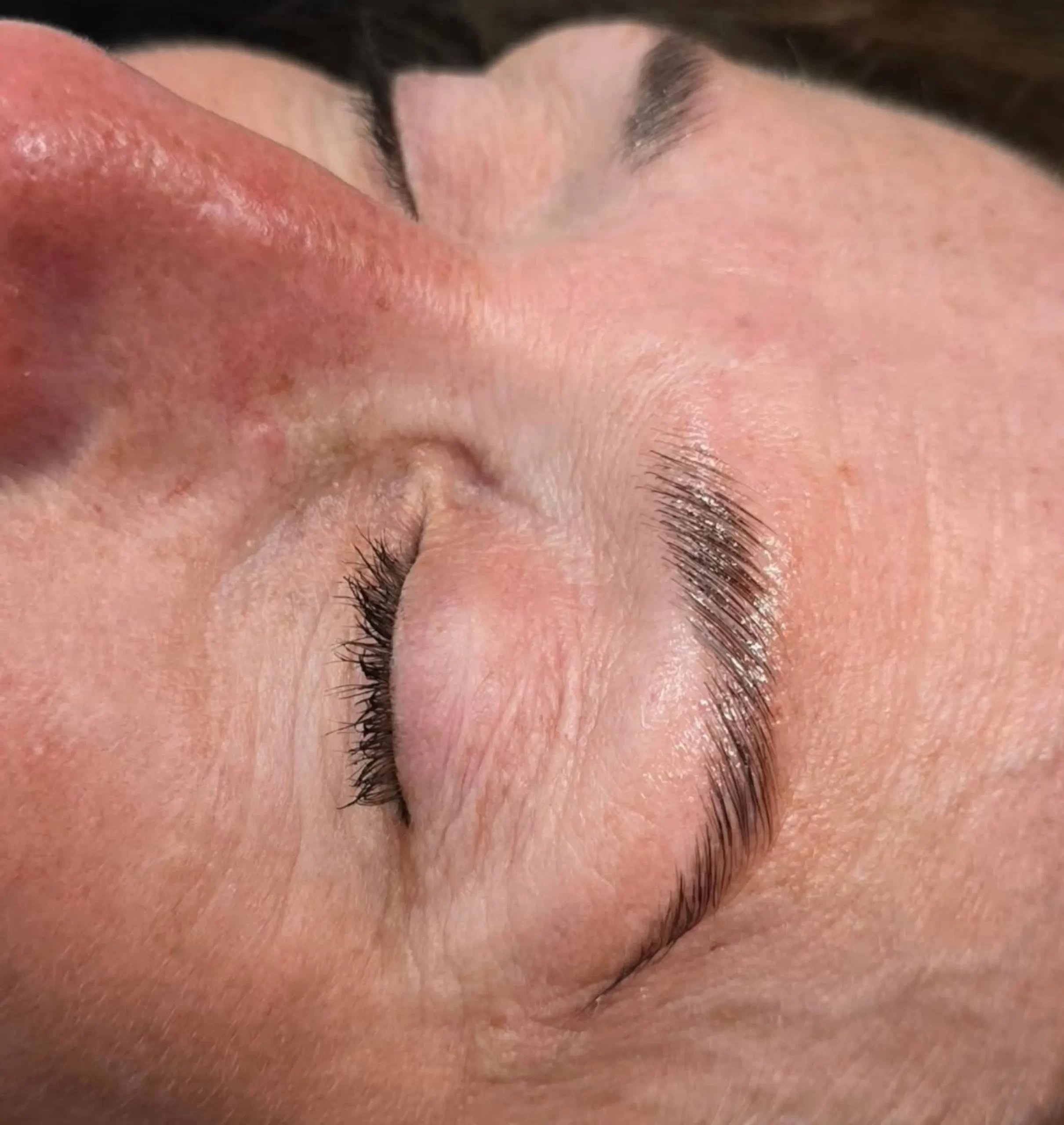 skin penetration licence