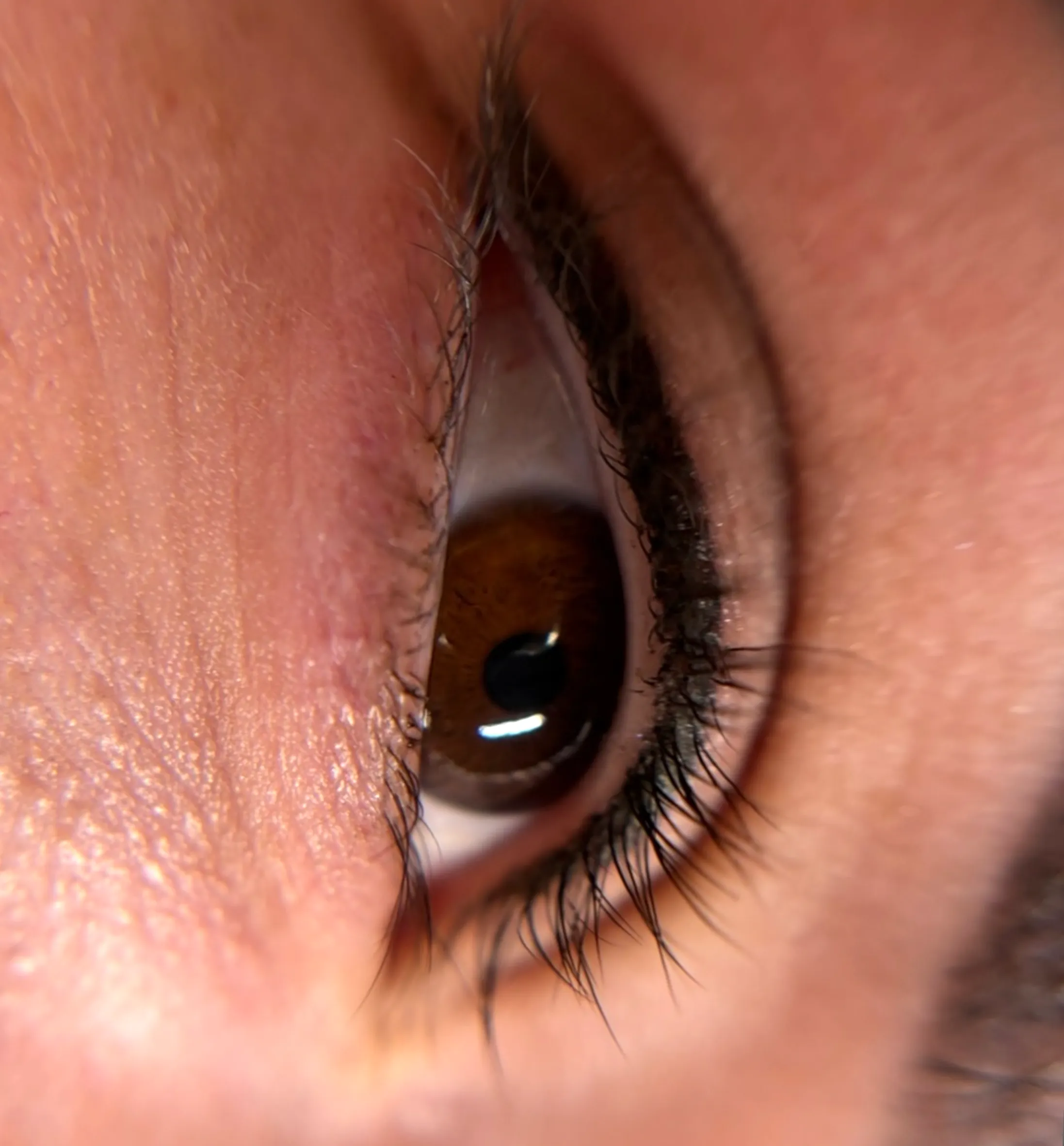 lash line enhancement