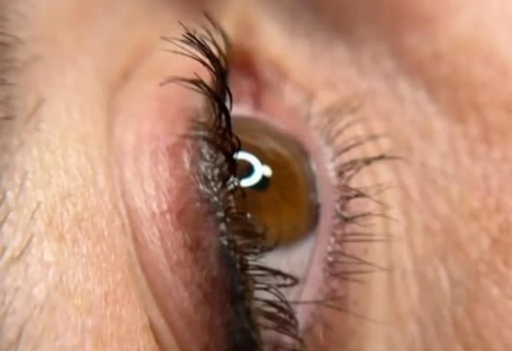 before and after eyelid tattoo