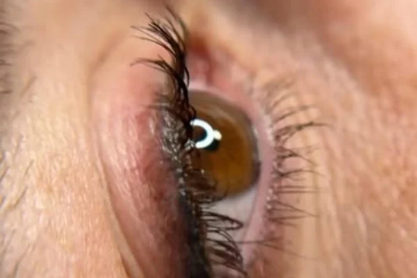 before and after eyelid tattoo