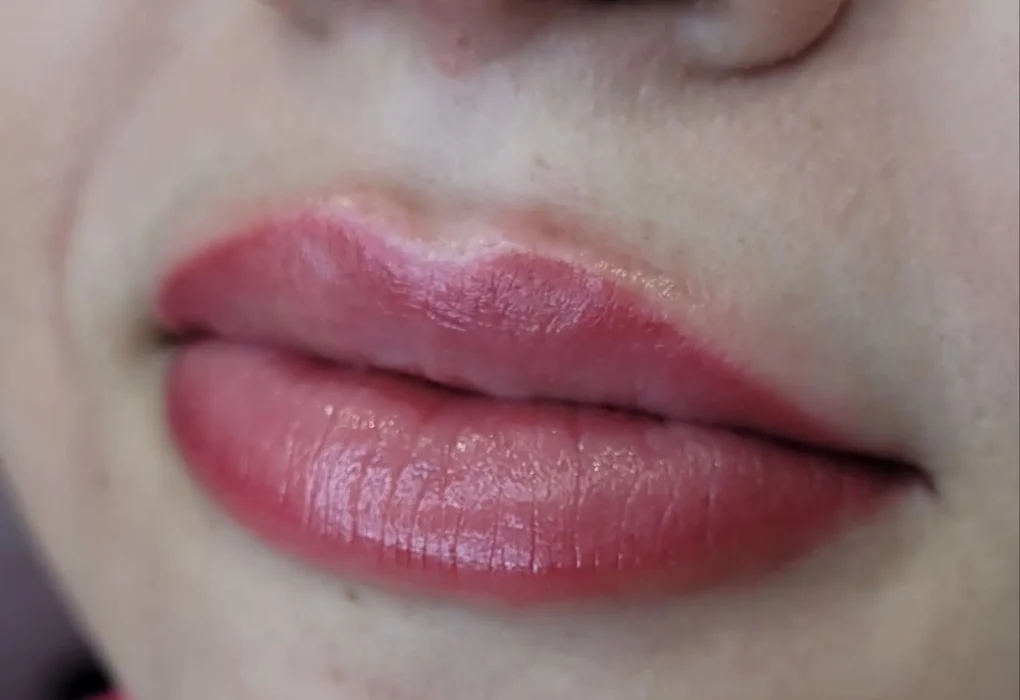 dark lip neutralisation before after brisbane