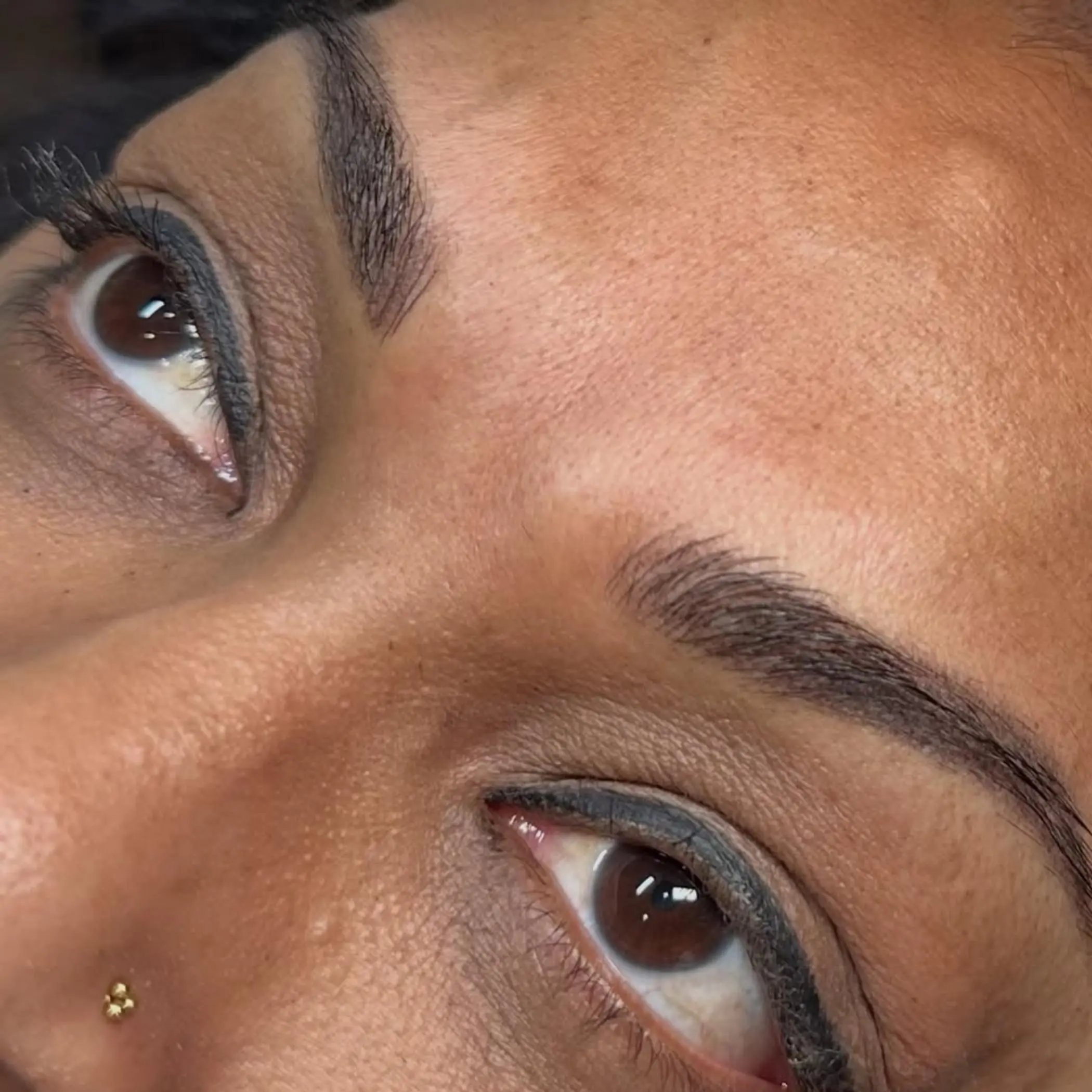 eyebrow tattoo laser removal process