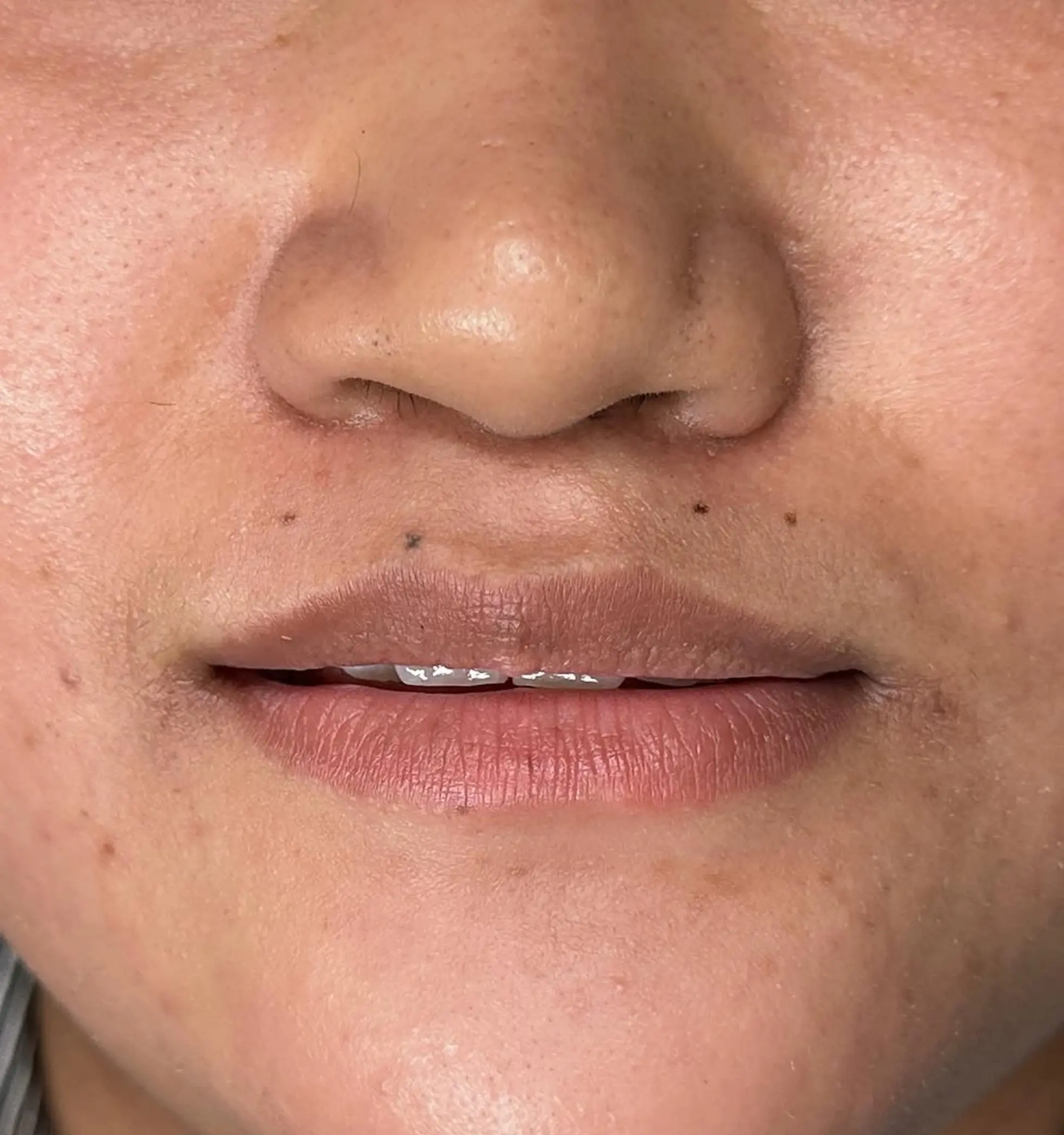 lip neutralisation tattooing process brisbane